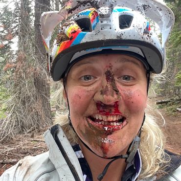 Smiling cyclist with a bloody face and helmet after a fall.