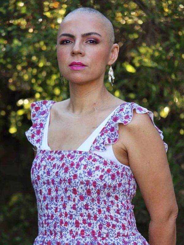 Portrait of myself in January 2022 after losing my hair due to chemotherapy for my Breast cancer 