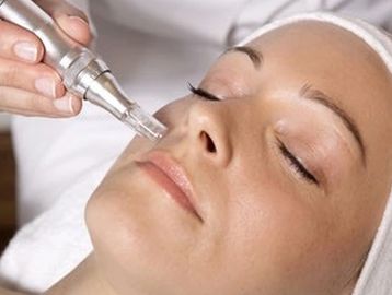 Nano microneedling facial