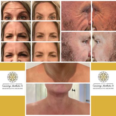 Collage image of forehead of a lady