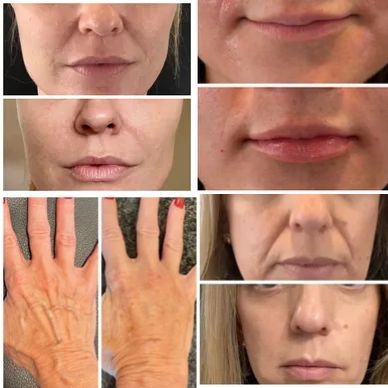 Collage image of face of an old woman