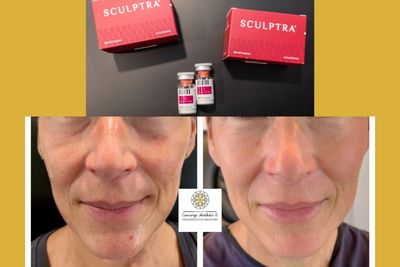Sculpture medicine boxes in red color and black background