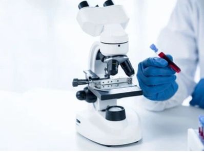 Lab analysis of blood samples for private cancer screening at Dermal Plus Clinic