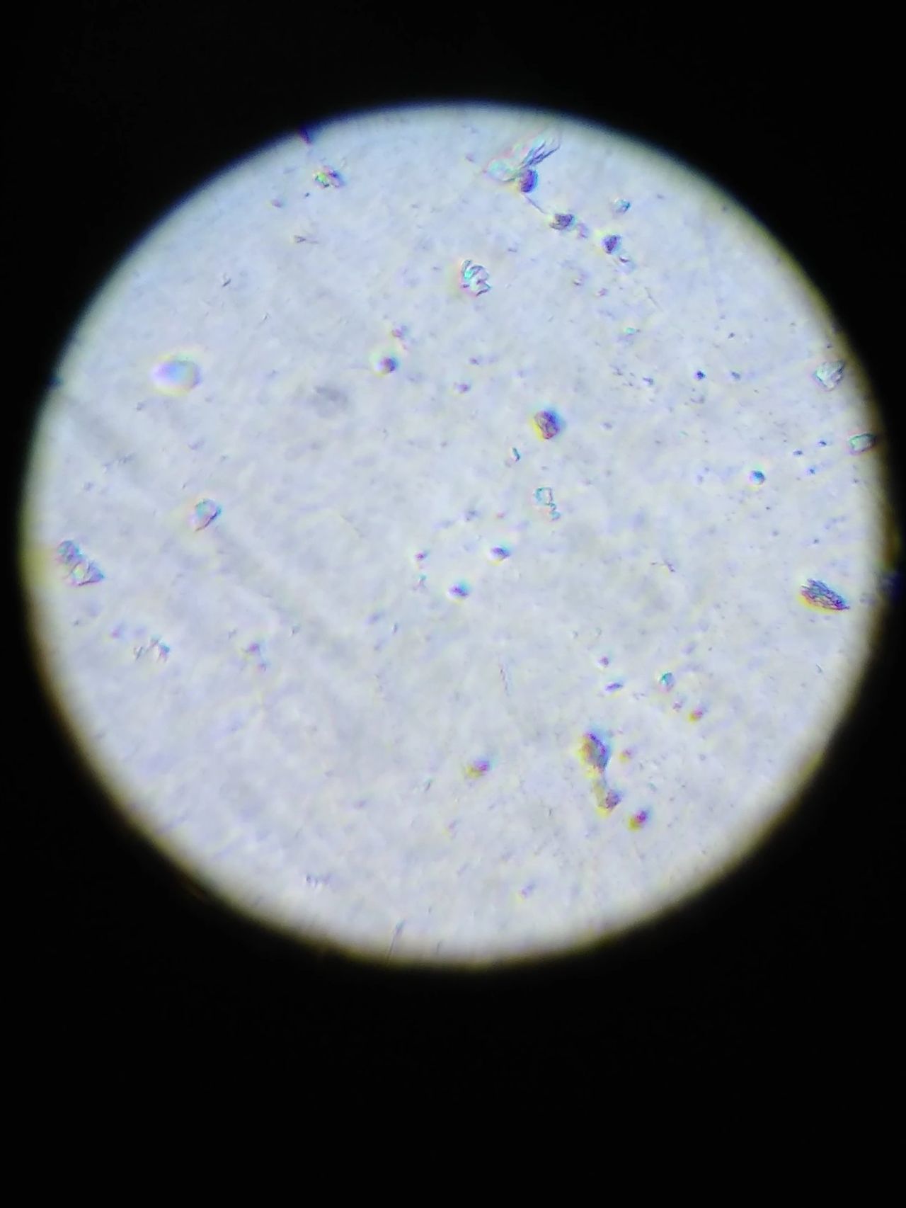 This is an image I took of my plasma. We did this in suboptimal conditions so it is unclear whether maybe the sample was contaminated (or even the microscope slides were a bit scratched or something?). But they certainly look like what could be microclots? This is an image I took of my plasma. We did this in suboptimal conditions so it is unclear whether maybe the sample was contaminated (or even the microscope slides were a bit scratched or something?). But they certainly look like what could be microclots?