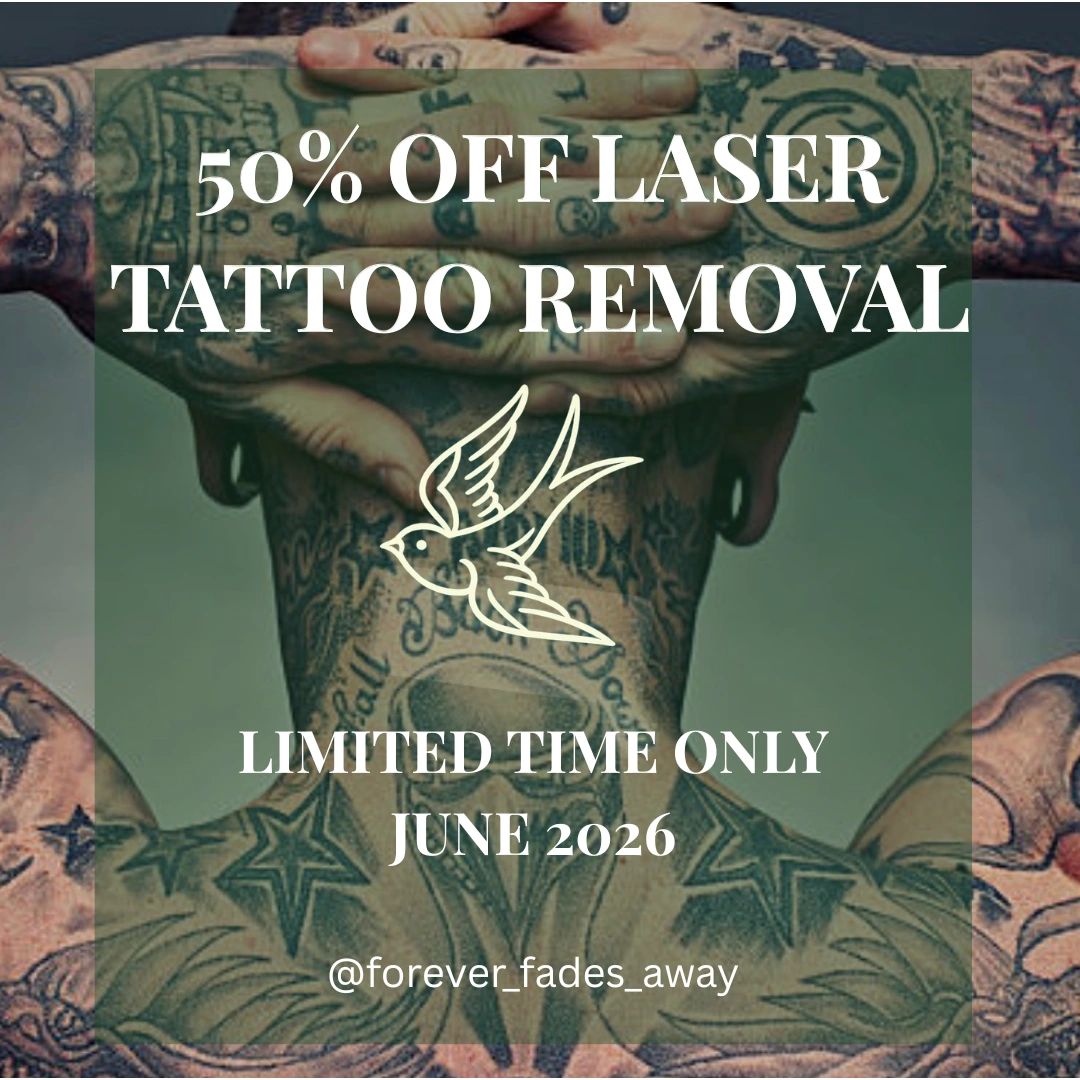 50% off laser tattoo removal, limited time June 2026.