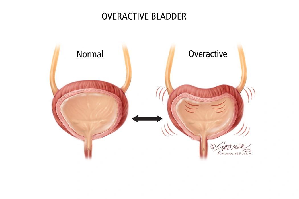 bladder-control-and-constipation