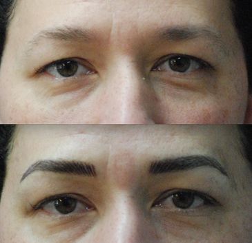 Eyebrow Microblading tattoo removal and correction repair Page 3 - Eye Art  Studio