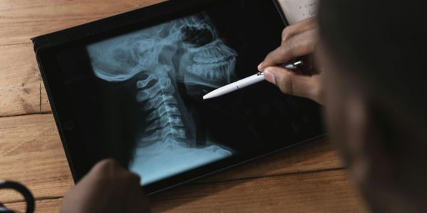 digital skeletal x-ray being reviewed by a black doctor