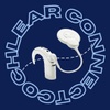 Cochlear Connect