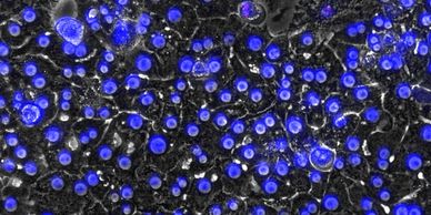 Primary Human Hepatocytes