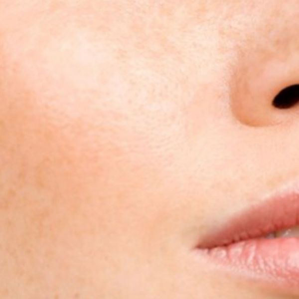 Close-up of healthy skin representing the importance of a strong, healthy skin barrier.