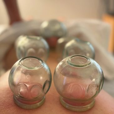 TCM cupping therapy