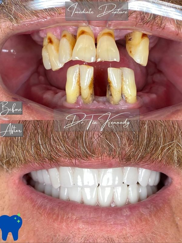Dentures Florence AL