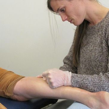 Dry Needling & it's Benefits — Women In Motion Physical Therapy & Wellness