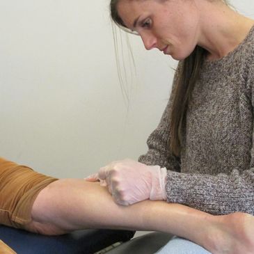 TDN, Trigger Point Dry Needling, Katherine Hauska, Becca Mohrbacher, Chris Shott