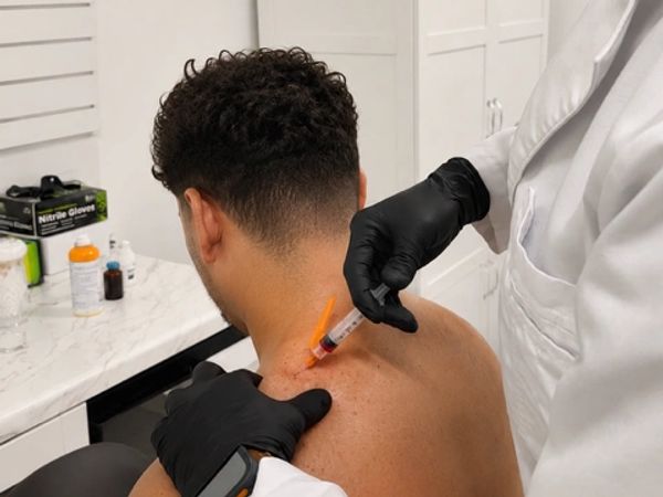 Healthcare provider administering a trigger point injection (TPI) to a patient’s shoulder for muscul