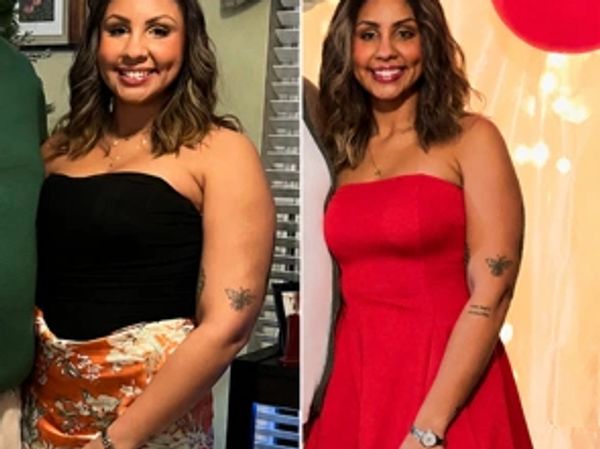 Before-and-after photos of a female patient showing her progress during a medically supervised weigh