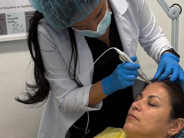 A provider performing a microneedling treatment on a patient's scalp