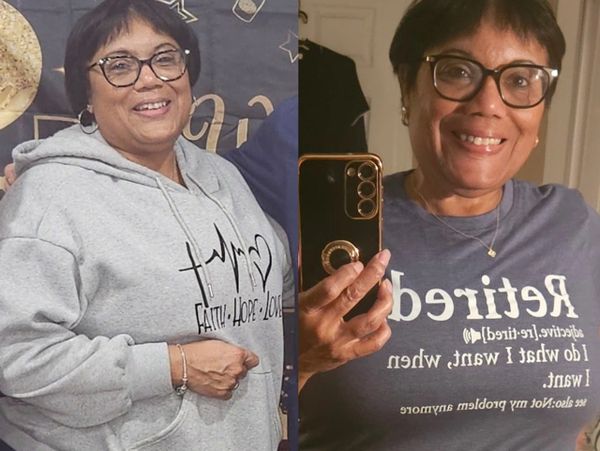 Before-and-after photos of a female patient showing her progress during a medically supervised weigh