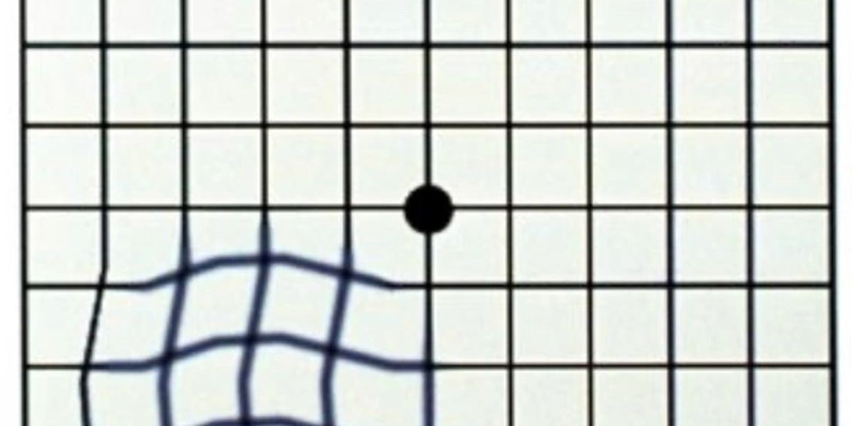  Amsler Eye Grid for Daily Screening of Eye Disease