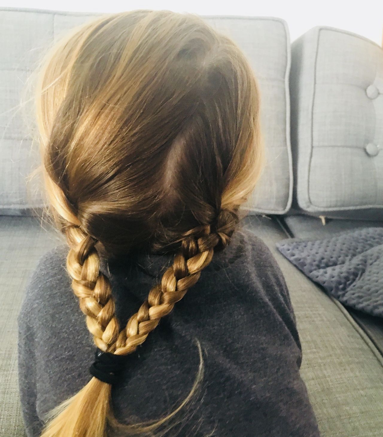 Trichotillomania In Toddlers A Wholistic Approach To Ocd
