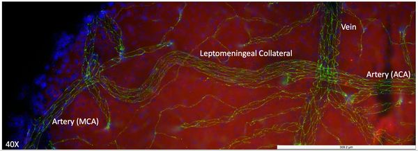 Leptomeningeal vessels: Cldn5 immune (green), Piezo1 mRNA (red), DAPI (blue)
