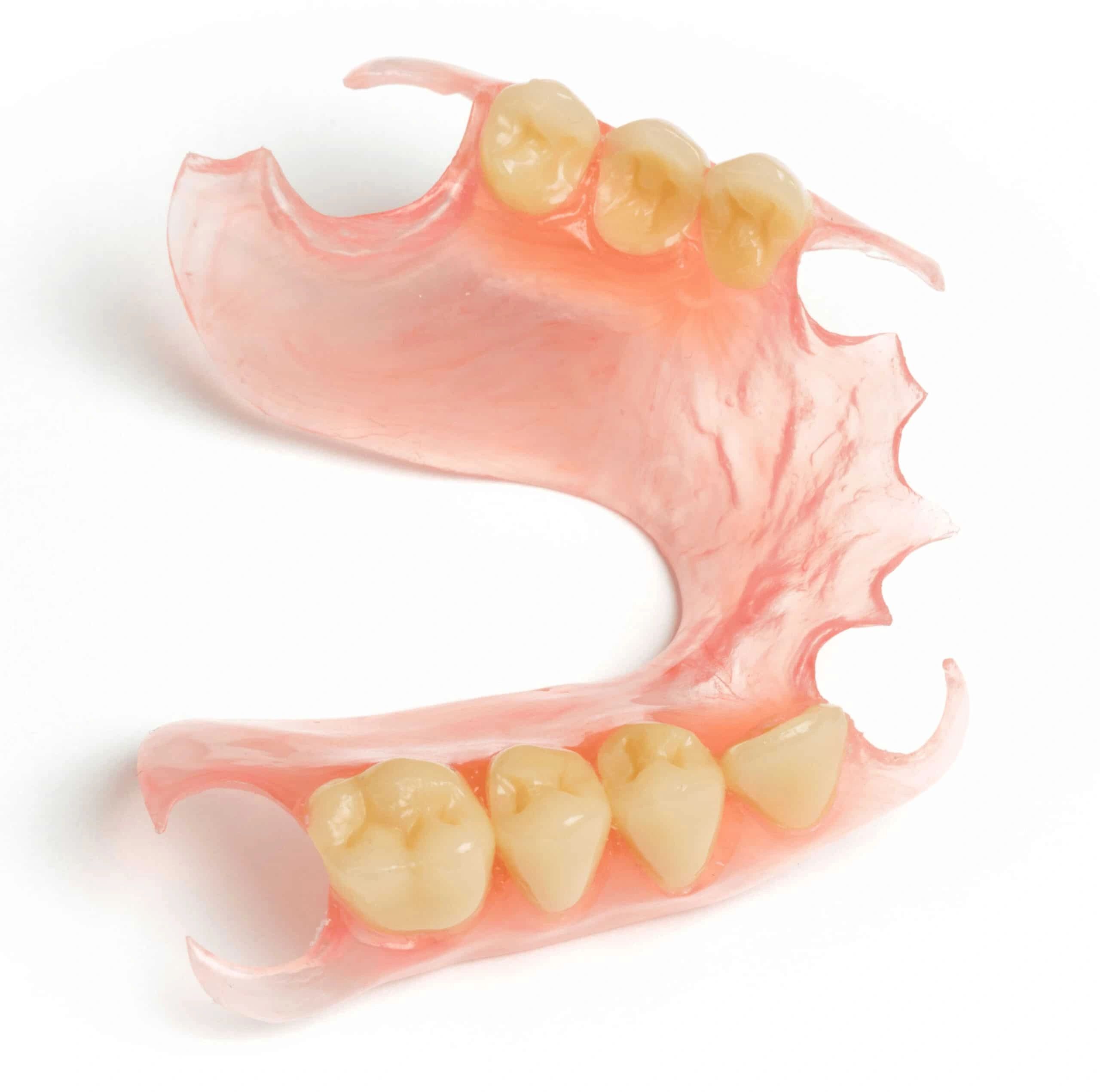 Flexible dentures, 10 of the most commonly asked questions