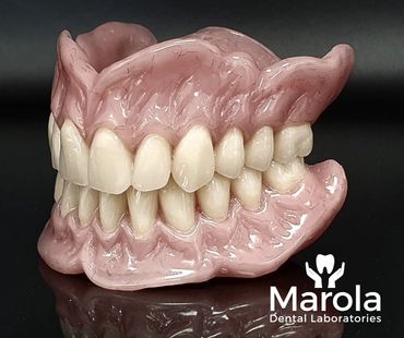 Acrylic denture