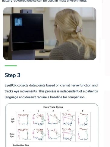 Steps of assessment of concussion