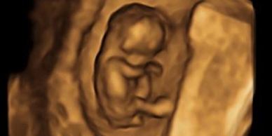 Pregnancy verification ultrasound Las Vegas, Henderson heartbeat check, 4D HD Live ultrasound
