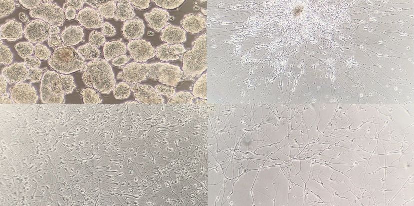 stem cell derived cells
