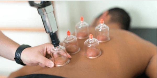 myofascial cupping, massage, back pain, blood flow, increased healing, mobility