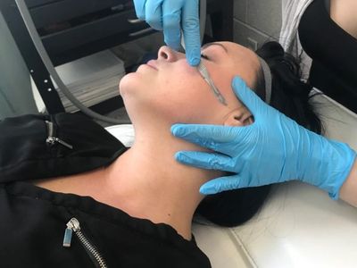 Dermaplaning - Dr. K. Insley Medical Aesthetics