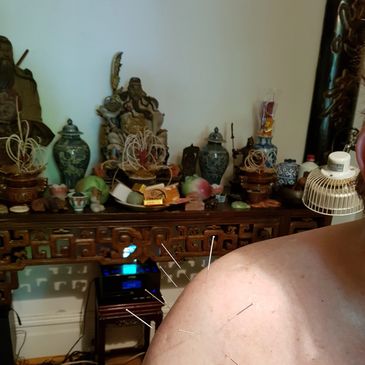 Acupuncture for shoulder injury