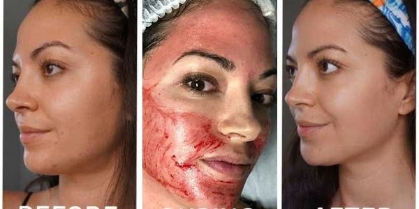 3 PHOTOS OPF THE SAME WOMAN MODELING CALIMIST SKIN BRIGHTENING CREAM FOR CALIMIST PROMOTION I