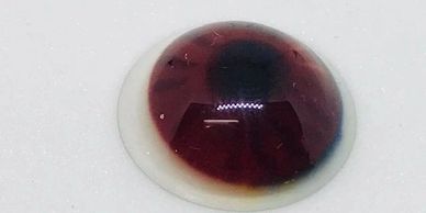 Iris tinted Scleral Shell customized with silicon impression of eyeball.