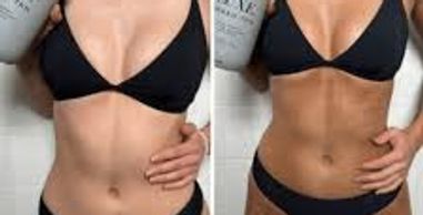 Before and after comparison of a woman's toned abdomen in a black bikini.