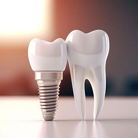 Dental implant next to a natural tooth model.