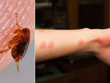 Close-up of a bed bug and red bite marks on a person's arm.