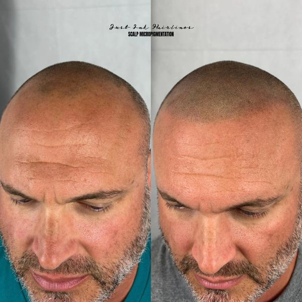 Scalp Micropigmenttation SMP Indialantic Florida, Palm Bay, Melbourne, Viera, Sebastian, Vero Beach