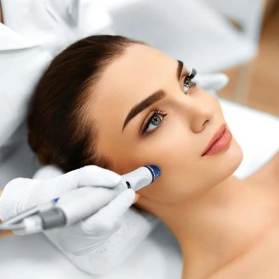 Rf microneedling and skin tightening 
