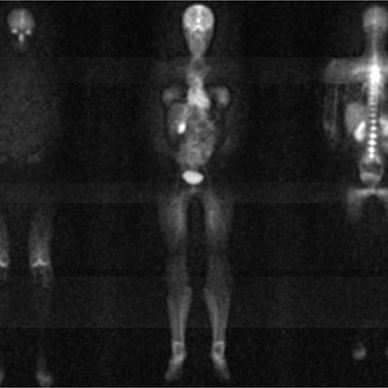 Sodium Magnetic Resonance Images of a female volunteer at 3T (6mm x 6mm in-plane resolution, 72mm sl