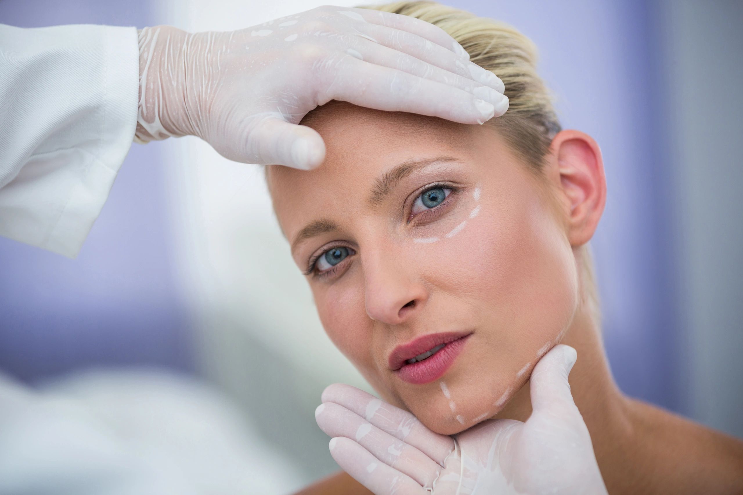 Primer plano de mujer con marcas em rostro en preparación para rejuvenecimiento facial en spa médico
