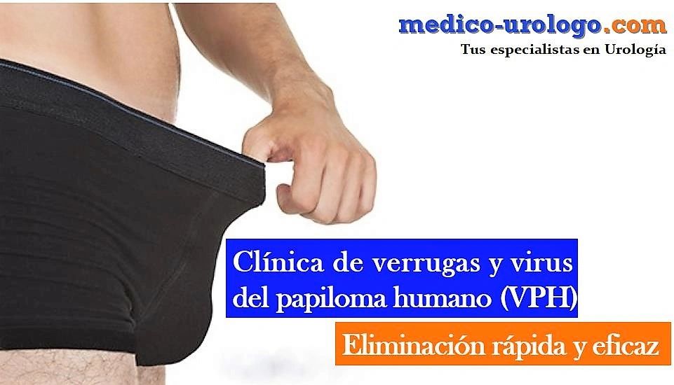 //img1.wsimg.com/isteam/ip/260c9e59-924b-40f3-b757-693e708d5fdc/uro.verrugas%20(1).jpeg/:/rs=w:1300,h:800