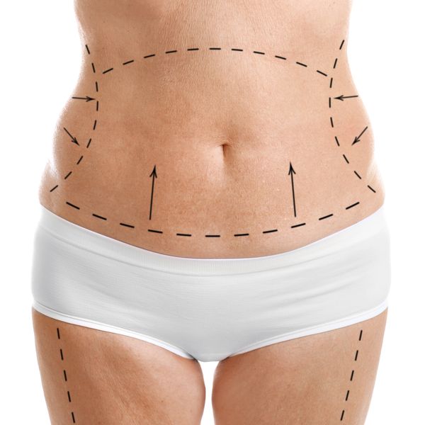 Cosmetic surgery