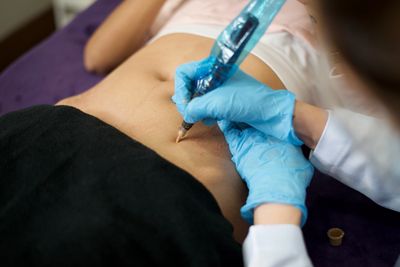 Paramedical tattooing