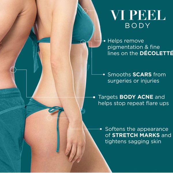 Vi peel body flyer 