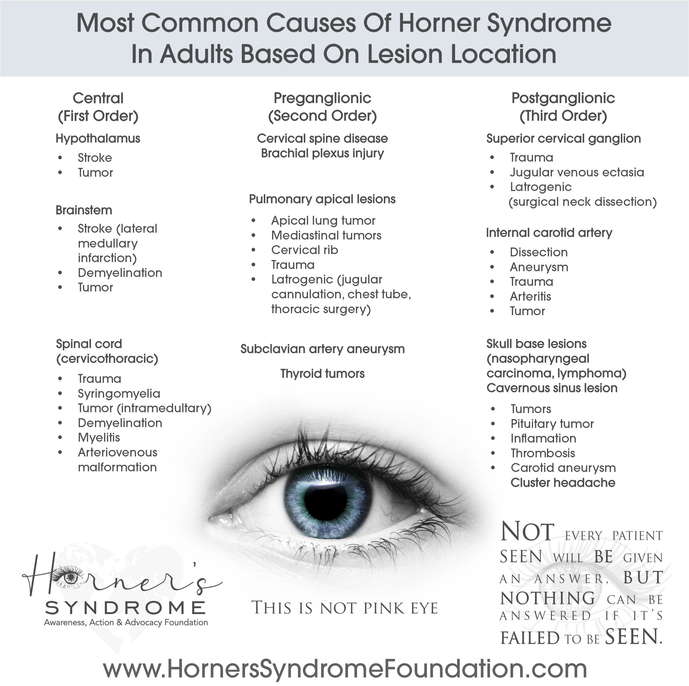 Púrpura Piscina Inconcebible Horner's Syndrome | Horner's Syndrome: Awareness, Action & Advocacy  Foundation