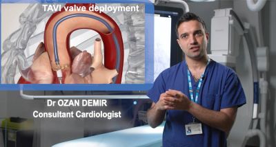 Consultant cardiologist explaining TAVI valve deployment.