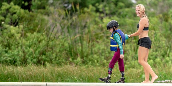 A woman helps a child with prosthetic legs walk on a dock outdoors.
